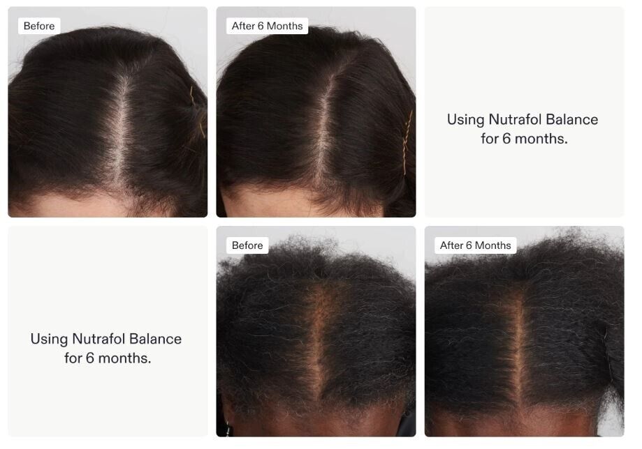 Nutrafol Women's Balance - Hair Growth Nutraceutical Supplement, 120 Capsules - ROYAL CROWN CART -